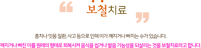 보철치료 충치나 잇몸 질환,사고 등으로 인해 이가 깨지거나 빠지는 수가 있습니다 깨지거나 빠진 이를 원래의 형태로 회복시켜 음식을 씹거나 발음 기능성을 되살리는 것을 보철치료 라고 합니다