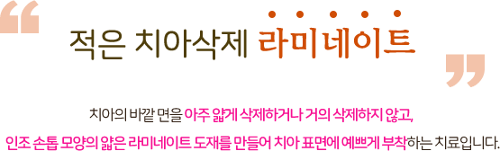 적은 치아삭제 라미네이트 치아의 바깥면을 아주 얇게 삭제하거나 거의 삭제하지 않고, 인조 손톱 모양의 얇은 라미네이트 도재를 만들어 치아 포면에 예쁘게 부착 하는 치료 입니다.